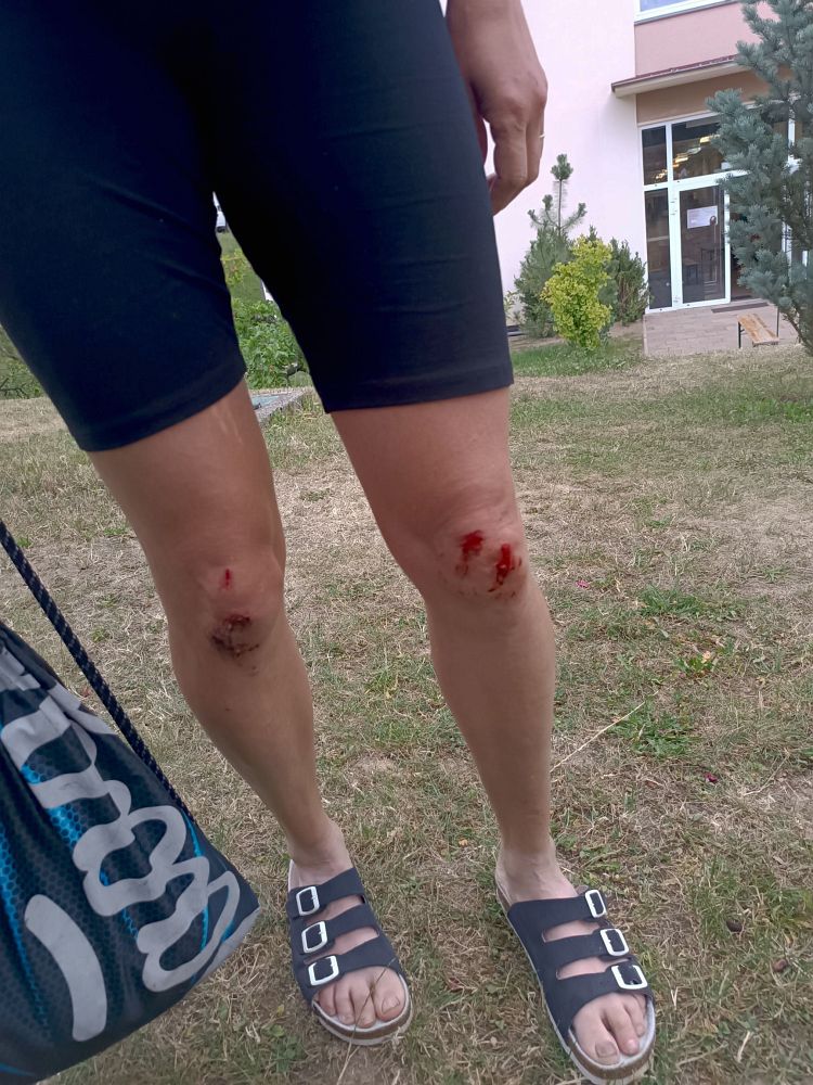 Táňa a její bolístky